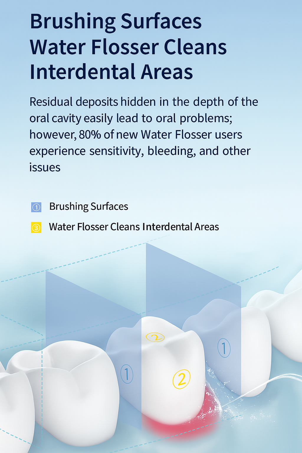 Ultrasonic Water Flosser