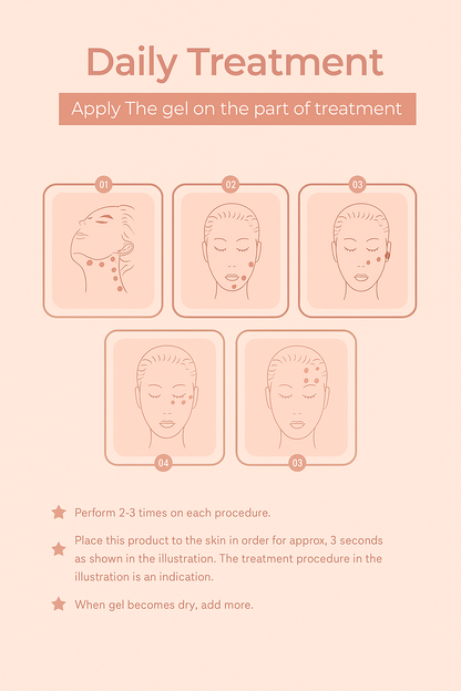 Hifu Anti Wrinkle Device